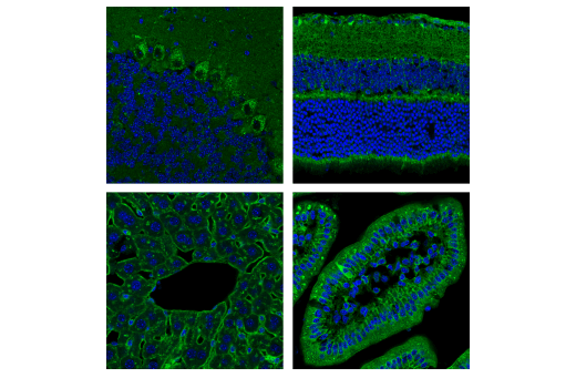 Immunofluorescence Image 1: Nicastrin (D4F6N) Rabbit Monoclonal Antibody