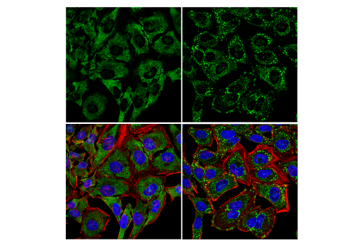 Immunofluorescence Image 1: UBAP2L (E5X4E) Rabbit Monoclonal Antibody