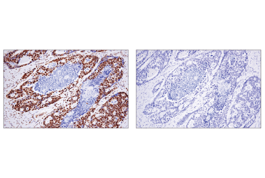 Immunohistochemistry Image 1: PTBP1 (E5O2S) Rabbit Monoclonal Antibody