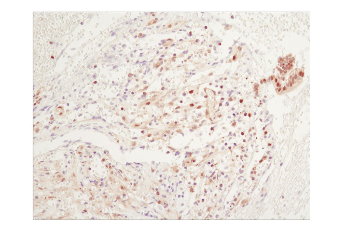 Immunohistochemistry Image 4: NF-kappaB p65 (D14E12) Rabbit Monoclonal Antibody