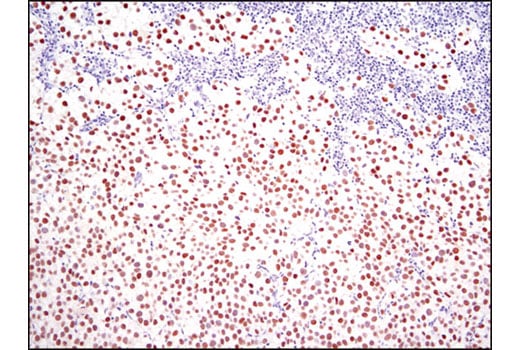 undefined Image 5: StemLight<sup>™</sup> Pluripotency Transcription Factor IF Antibody Sampler Kit