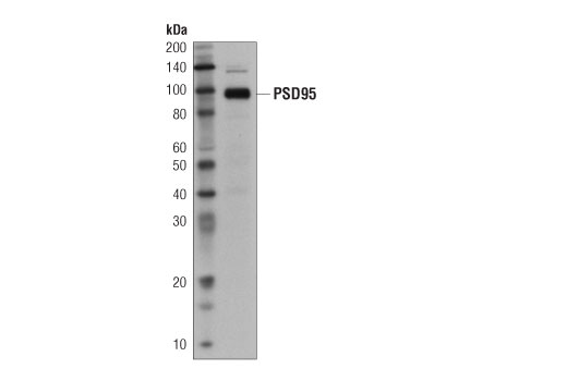Western Blotting Image 2: Mouse Brain Tissue Control Extracts