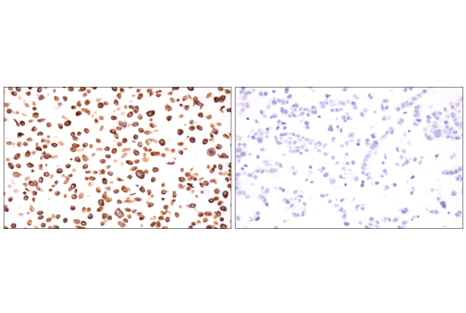 Immunohistochemistry Image 4: Keratin 7 (RN7) Mouse Monoclonal Antibody