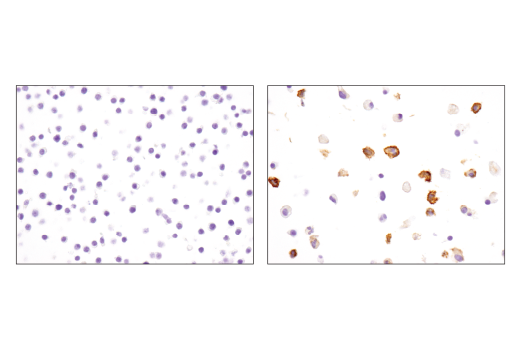 Immunohistochemistry Image 1: PD-L1 (D5V3B) Rabbit Monoclonal Antibody