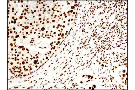 Immunohistochemistry Image 2: Histone H2B (D2H6) Rabbit Monoclonal Antibody