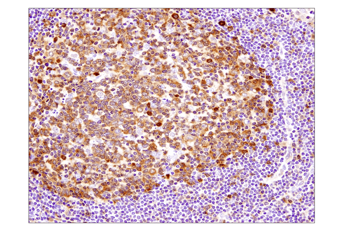 Immunohistochemistry Image 4: Caspase-3 (D3R6Y) Rabbit Monoclonal Antibody (IHC Formulated)