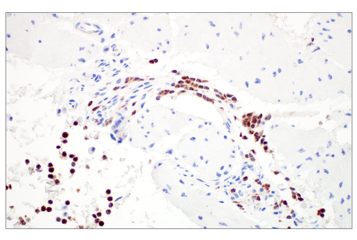 Immunohistochemistry Image 2: OLR1/LOX1 (E9C5A) Rabbit Monoclonal Antibody (BSA and Azide Free)