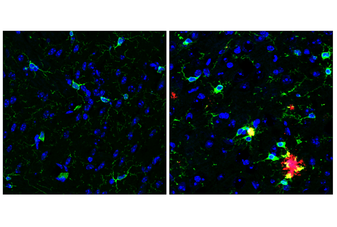 Immunofluorescence Image 1: HS1 (D5A9) Rabbit Monoclonal Antibody (BSA and Azide Free)
