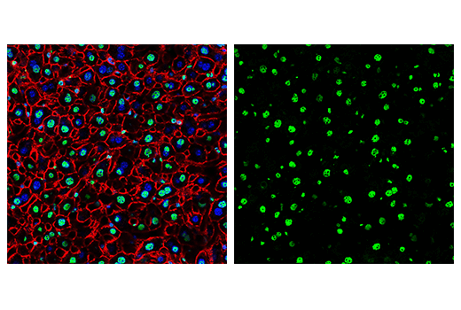 Immunofluorescence Image 2: FUS/TLS (E3O8I) Rabbit Monoclonal Antibody