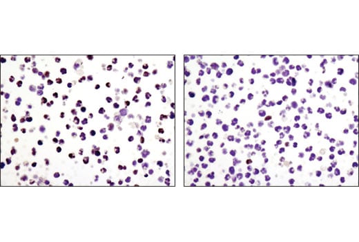 Immunohistochemistry Image 3: HES1 (D6P2U) Rabbit Monoclonal Antibody (BSA and Azide Free)