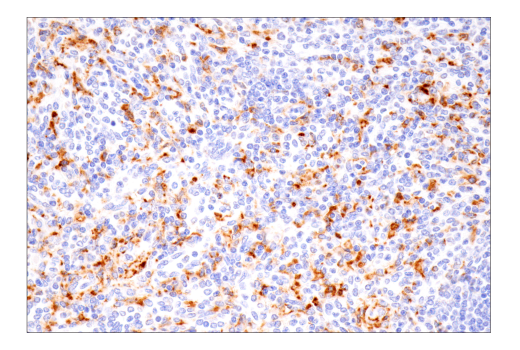Immunohistochemistry Image 4: CD68 (D4B9C) Rabbit Monoclonal Antibody (BSA and Azide Free)