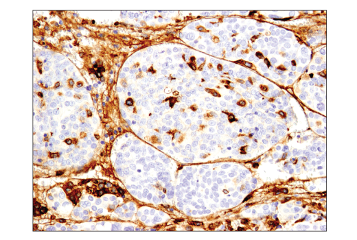 Immunohistochemistry Image 4: CD163 (D6U1J) Rabbit Monoclonal Antibody (BSA and Azide Free)