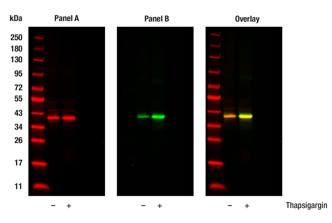 Western Blotting Image 1: Phospho-eIF2 alpha (Ser51) (D9G8) Rabbit Monoclonal Antibody