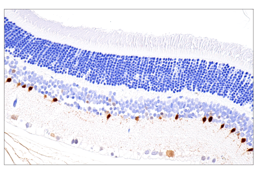 Immunohistochemistry Image 9: Parvalbumin (E8N2U) Rabbit Monoclonal Antibody