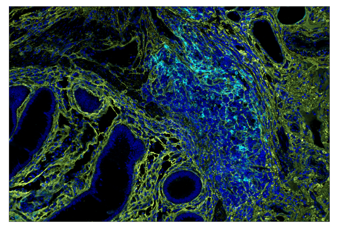 Immunohistochemistry Image 2: CD40 (D8W3N) & CO-0115-488 SignalStar<sup>™</sup> Oligo-Antibody Pair