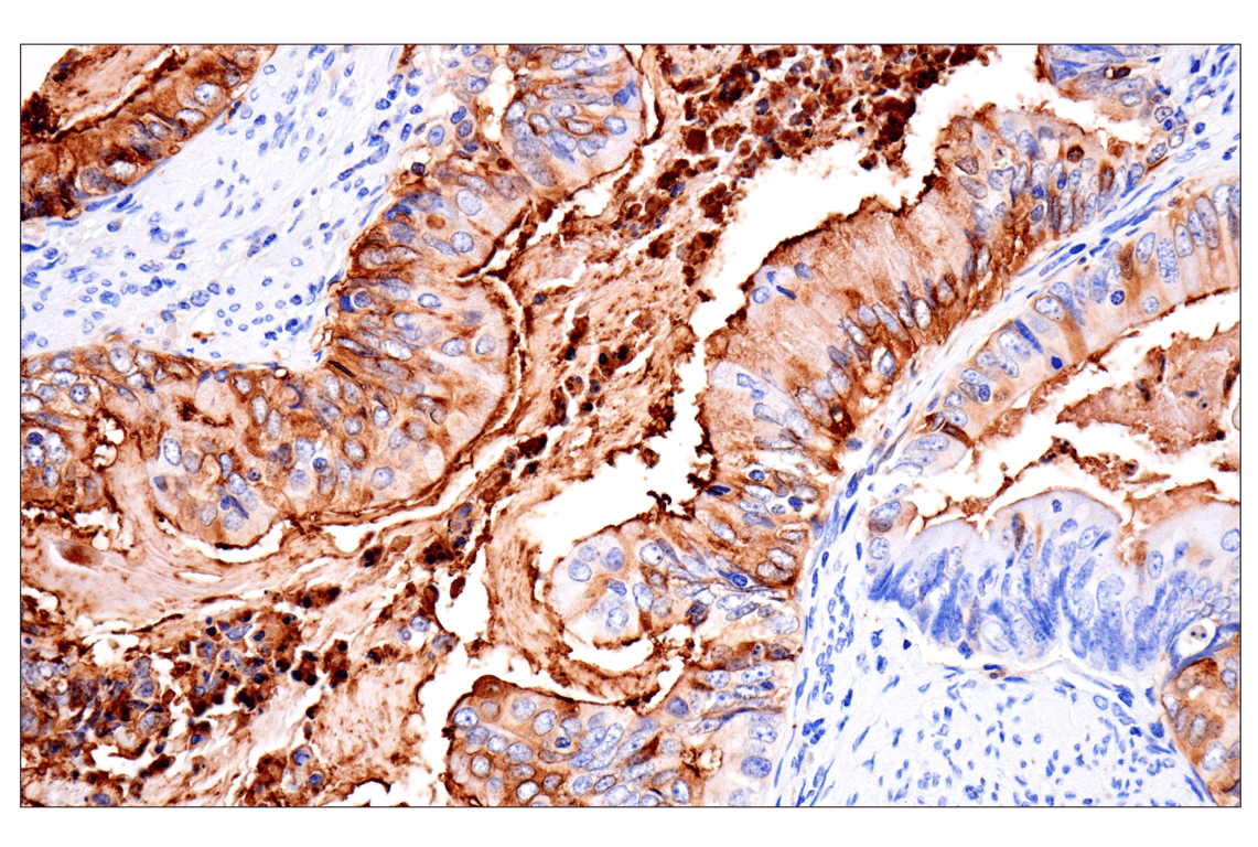 Immunohistochemistry Image 1: CD177 (F9O5U) Rabbit Monoclonal Antibody