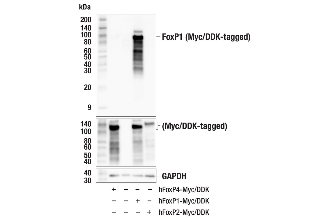 Western Blotting Image 2: FoxP1 (D35D10) Rabbit Monoclonal Antibody