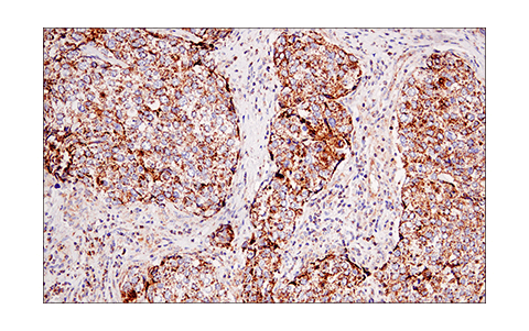 Immunohistochemistry Image 4: IDH2 (KrMab-3) Mouse Monoclonal Antibody