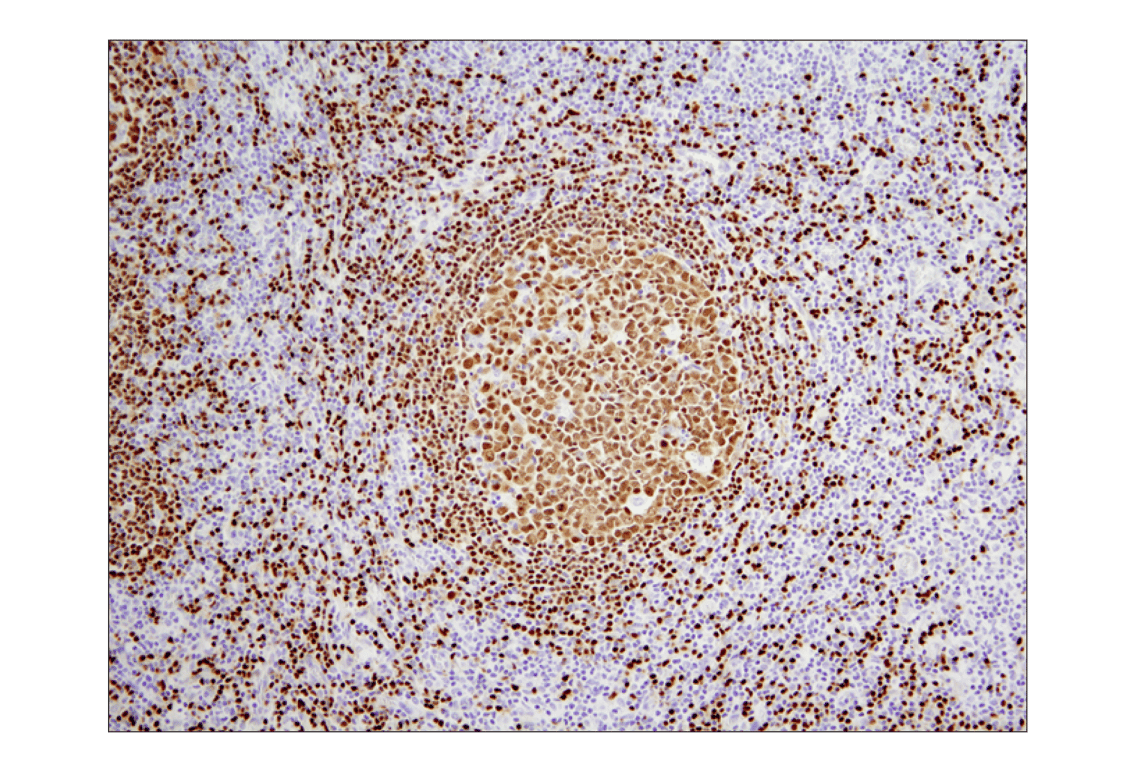 Immunohistochemistry Image 2: PAX5 (D7H5X) Rabbit Monoclonal Antibody