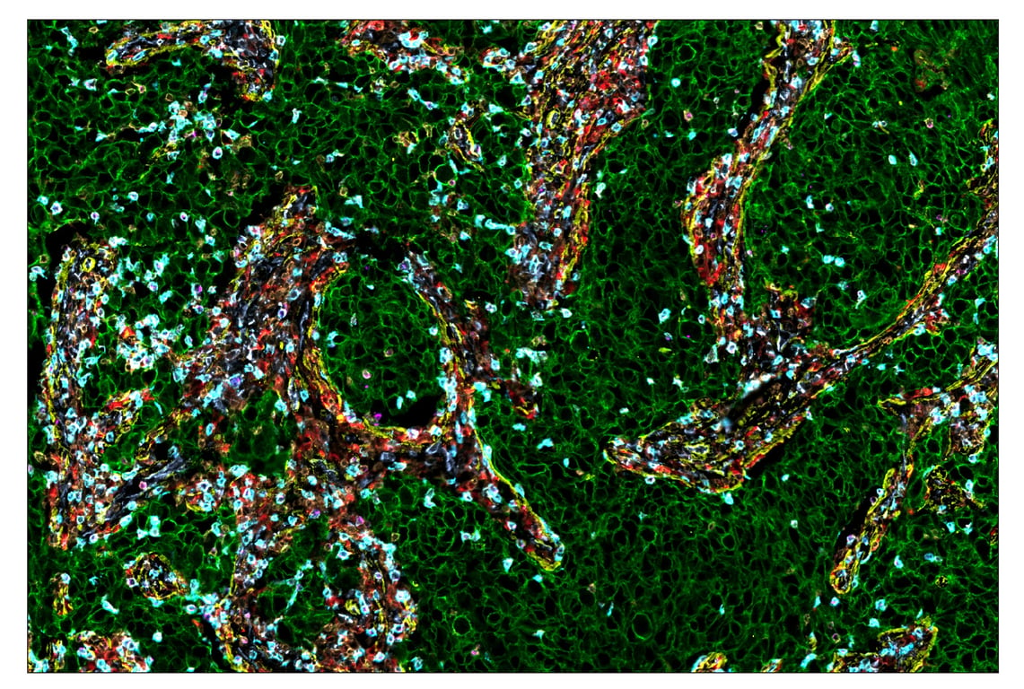 Immunohistochemistry Image 1: CD68 (D4B9C) & CO-0007-647 SignalStar<sup>™</sup> Oligo-Antibody Pair