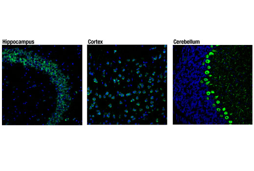 undefined Image 23: Late-Onset Alzheimer's Disease Risk Gene (Mouse Model) Antibody Sampler Kit