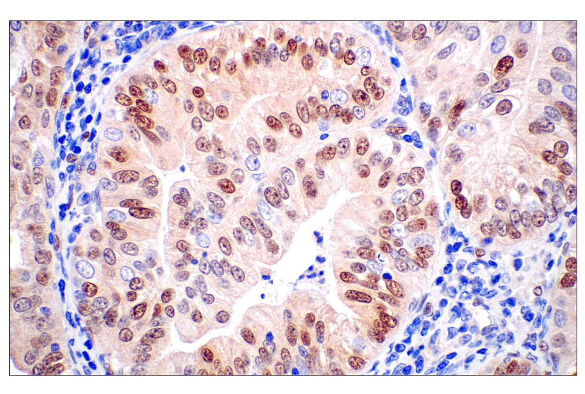 Immunohistochemistry Image 1: ID1 (F2M1J) Rabbit Monoclonal Antibody (BSA and Azide Free)