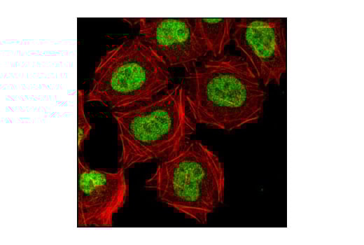 Immunofluorescence Image 1: CDK9 (C12F7) Rabbit Monoclonal Antibody (BSA and Azide Free)