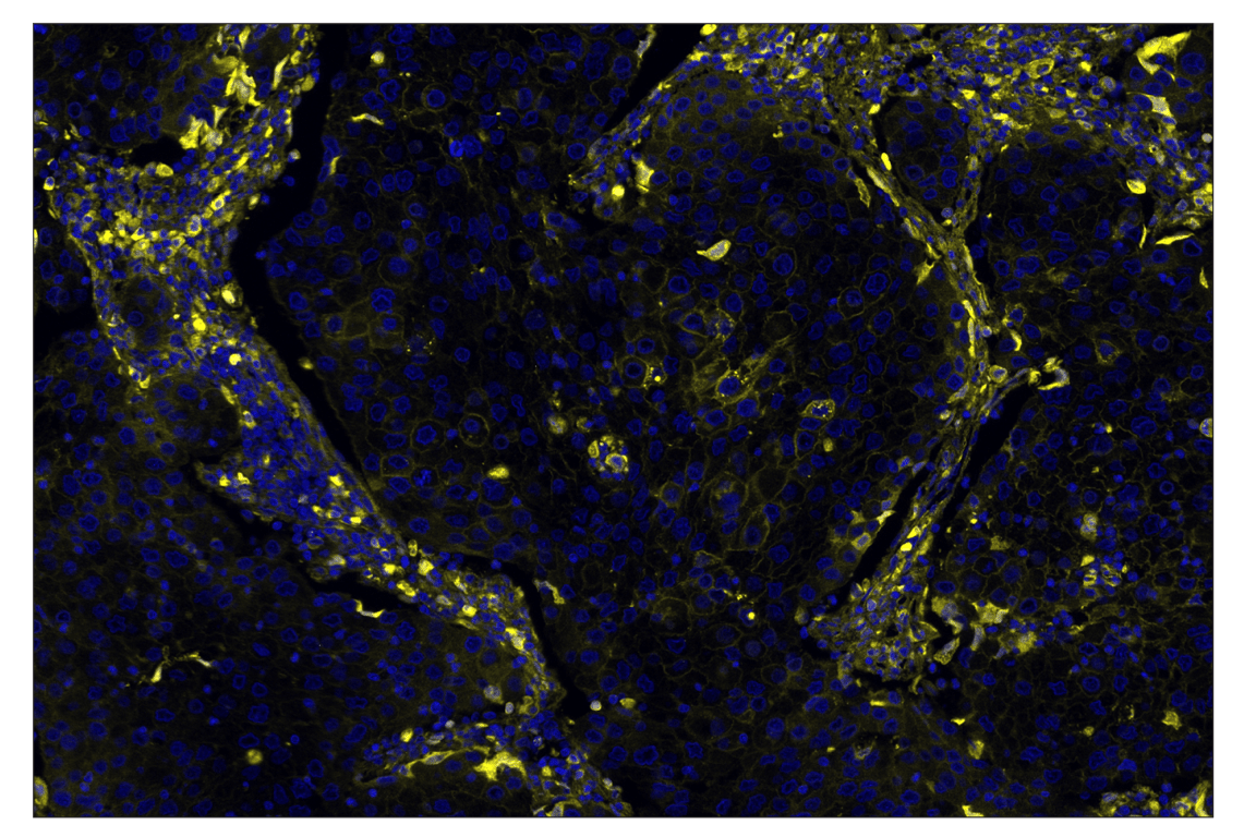 Immunohistochemistry Image 2: FGF Receptor 1 (D8E4) & CO-0156-488 SignalStar<sup>®</sup> Oligo-Antibody Pair