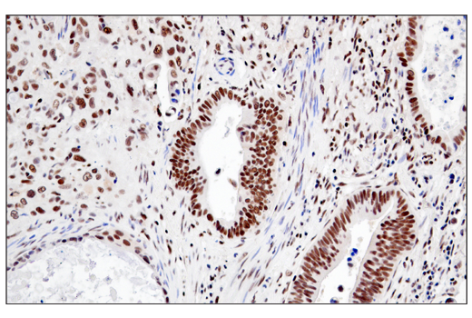 Immunohistochemistry Image 2: RPA32/RPA2 (E8X5P) XP<sup>®</sup> Rabbit mAb