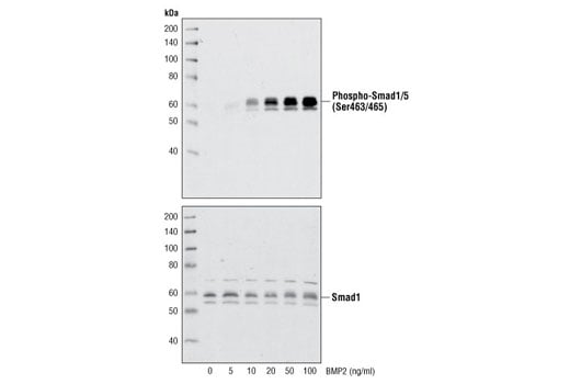 undefined Image 3: Human BMP-2 Recombinant Protein