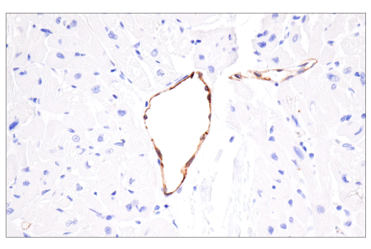 Immunohistochemistry Image 6: CD62P/P-Selectin (E8Q1W) Rabbit Monoclonal Antibody