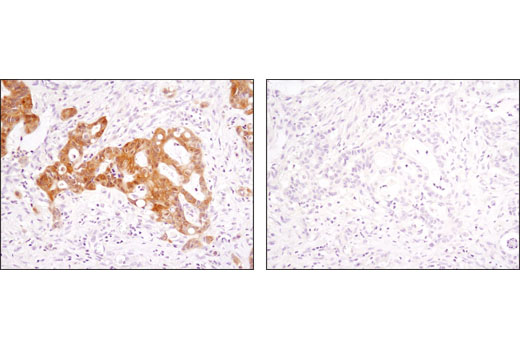 Immunohistochemistry Image 2: Phospho-p90RSK (Thr359) (D1E9) Rabbit Monoclonal Antibody (BSA and Azide Free)