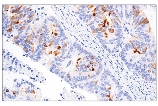 Immunohistochemistry Image 1: RHAMM/CD168 (E7S4Y) Rabbit Monoclonal Antibody