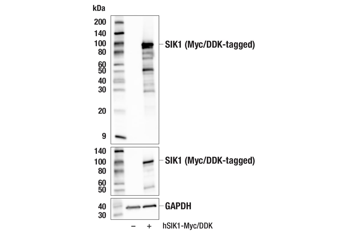 Western Blotting Image 3: SIK1 (F5D8F) Rabbit Monoclonal Antibody