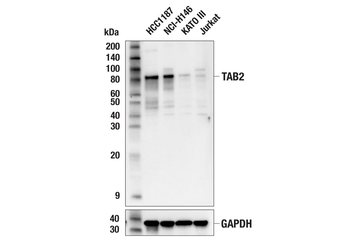 TAB2 (C88H10) Rabbit mAb | Cell Signaling Technology