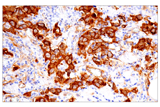 Immunohistochemistry Image 1: CRP2 (E8R5N) Rabbit Monoclonal Antibody