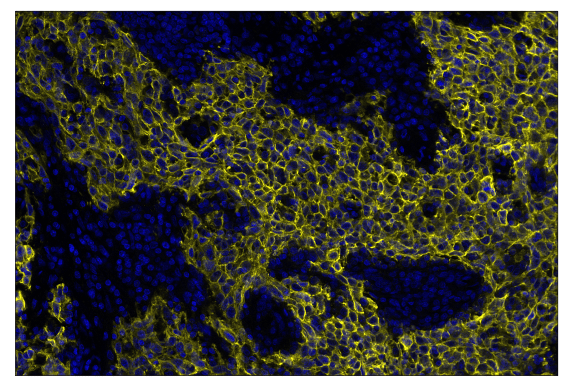 Immunohistochemistry Image 2: TACSTD2/TROP2 (F4W4J) & CO-0150-488 SignalStar<sup>™</sup> Oligo-Antibody Pair