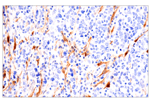 Immunohistochemistry Image 3: NNMT (E6N2Z) Rabbit Monoclonal Antibody
