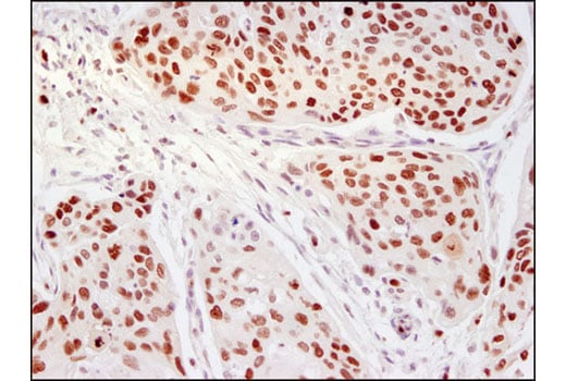 Immunohistochemistry Image 2: Ezh2 (D2C9) Rabbit Monoclonal Antibody (BSA and Azide Free)