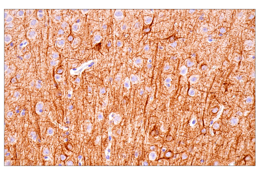 Immunohistochemistry Image 5: Neurofilament-M (E7L2T) Rabbit Monoclonal Antibody