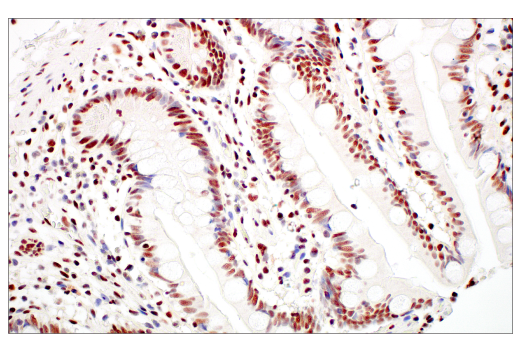 Immunohistochemistry Image 7: Rad50 (E4J5R) Rabbit Monoclonal Antibody