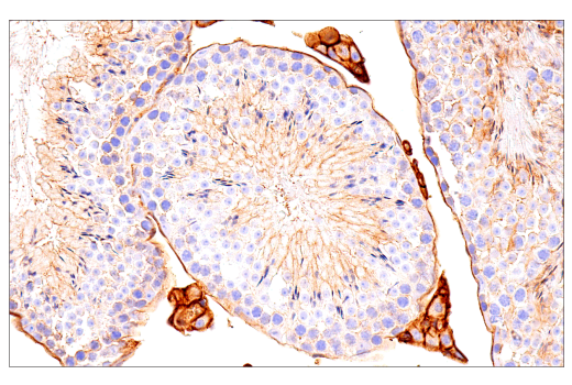 Immunohistochemistry Image 3: Crry (E9F1S) Rabbit Monoclonal Antibody