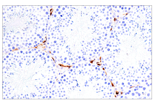 undefined Image 35: Xenophagy Antibody Sampler Kit