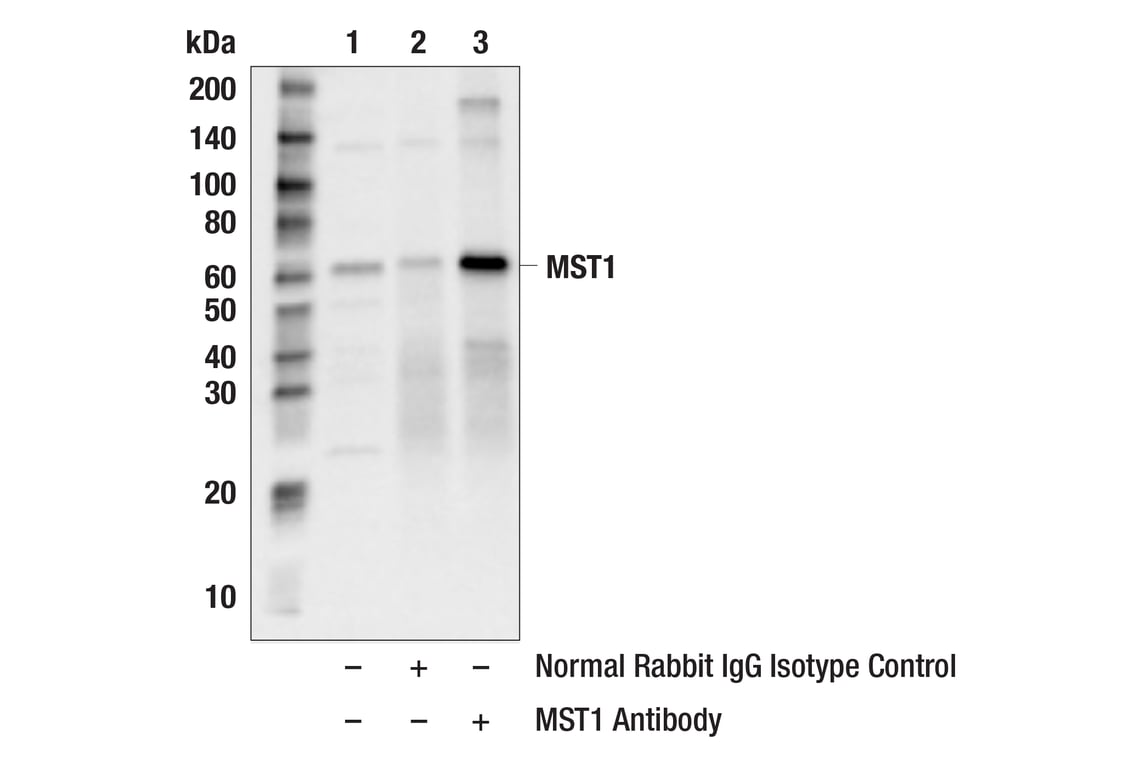 undefined Image 29: Hippo Signaling Antibody Sampler Kit