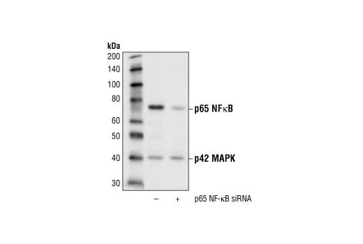 undefined Image 2: SignalSilence<sup>®</sup> NF-kappaB p65 siRNA I
