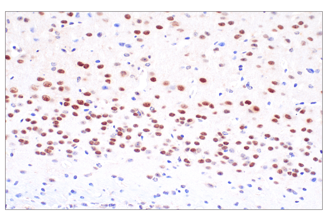 Immunohistochemistry Image 9: Phospho-ATP-Citrate Lyase (Ser455) (F4T8R) Rabbit Monoclonal Antibody
