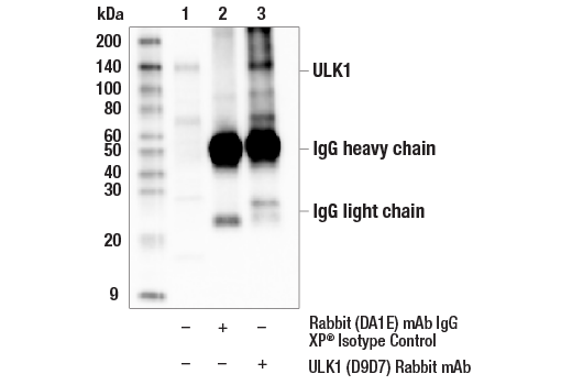 Immunoprecipitation Image 1: ULK1 (D9D7) Rabbit Monoclonal Antibody
