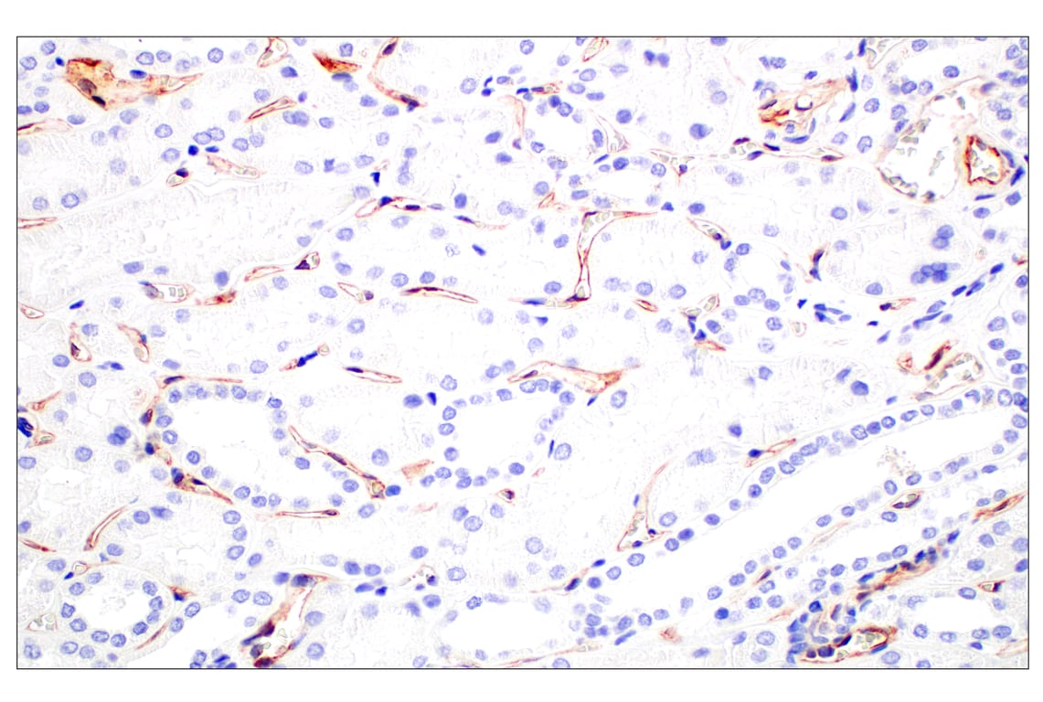 Immunohistochemistry Image 6: CD93/C1qR (E5H9B) Rabbit Monoclonal Antibody