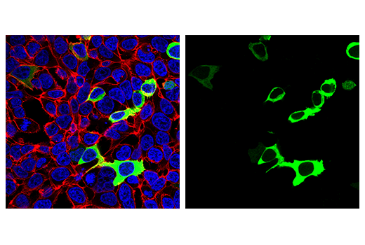 Immunofluorescence Image 1: SARS-CoV-2 Nucleocapsid Protein (HL344) Rabbit Monoclonal Antibody