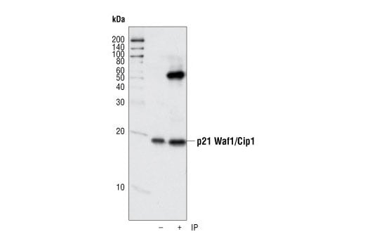Immunoprecipitation Image 1: p21 Waf1/Cip1 (12D1) Rabbit Monoclonal Antibody